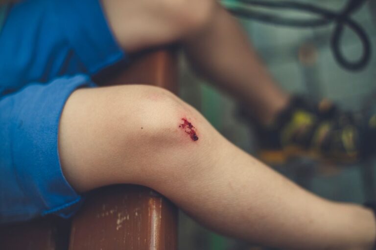pickleball knee injuries